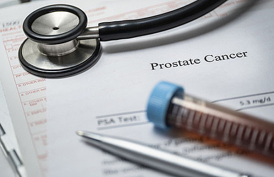 Prostate cancer: How long should hormonal therapy last?